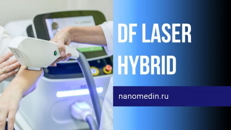Лазер DF Laser Hybrid